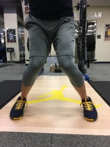 Do your basketball players have Valgus Knees?